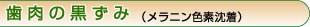 歯肉の黒ずみ（メラニン色素沈着）